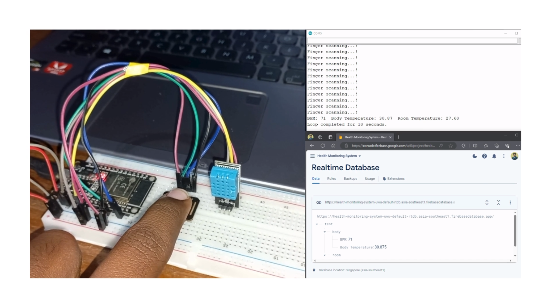 BeatSense IoT Monitoring